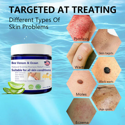Bee Venom & Ocean Natural Eczema Psoriasis Relief Cream – Soothing & Healing Formula 🌿🐝